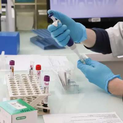 [Social] Grève annoncée dans les laboratoires d’analyses médicales...