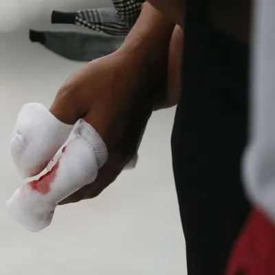 Nouvel An en Alsace : les urgences saturées après des accidents...