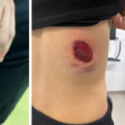 ASSE : les Green Angels dénoncent des violences policières à Dunkerque