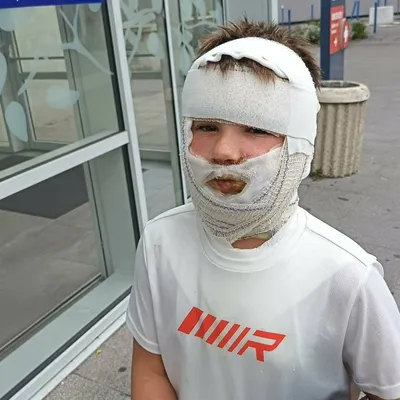 Saint-Omer : un enfant gravement brûlé après l'explosion d'un jouet...