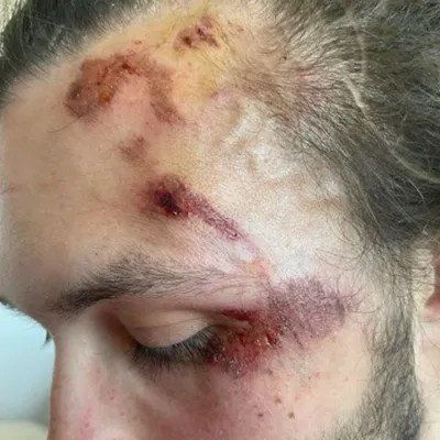 Appel à témoins à Boulogne-sur-Mer : Thomas, percuté violemment par...