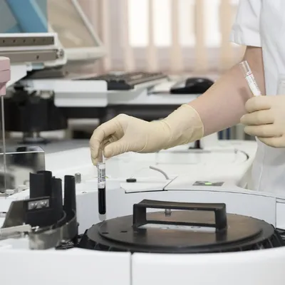 Mars Bleu : l'ARS lance un appel au dépistage dans la région