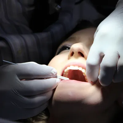 Soins dentaires : les patients bientôt moins remboursés