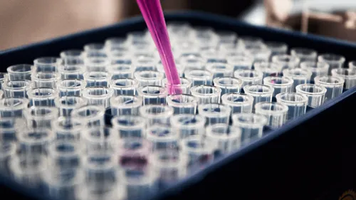 Un premier cas de variole du singe identifié en Italie