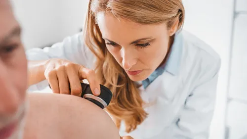 Les cancers de la peau bientôt dépistés par l'intelligence...