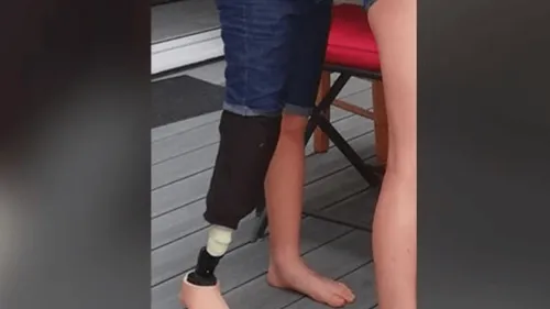 Vendée : des parents lancent un appel pour retrouver la prothèse de...