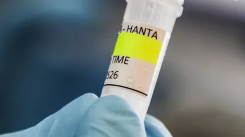 Hantavirus : la Française hospitalisée a la forme "la plus sévère"...