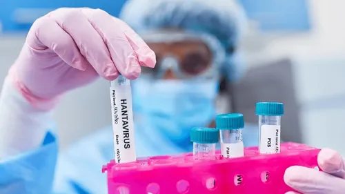 SONDAGE ALOUETTE : l'hantavirus vous inquiète-t-il ?