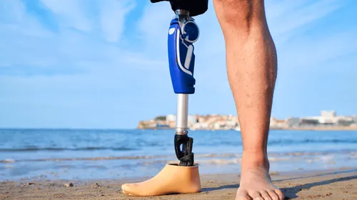 Les Sables d’Olonne : un enfant amputé perd sa prothèse dans la...