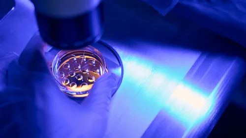 "Opération de solidarité" : dons de sperme entre Rennes et Lille