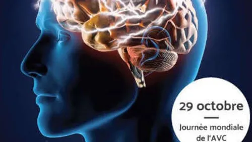 Journée Mondiale de l'AVC
