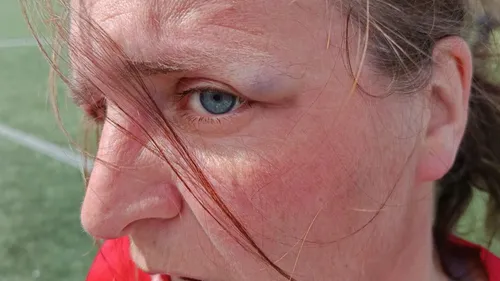 Une joueuse agressée lors d'un match de foot