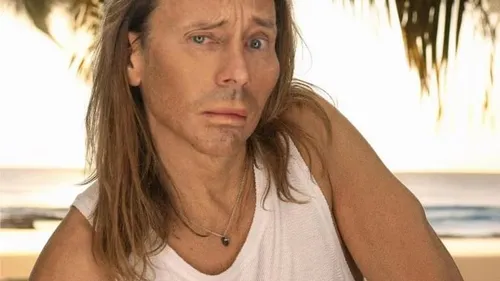 Bob Sinclar a-t-il fait usage du botox ?