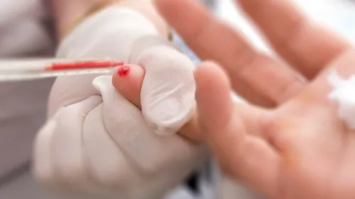 Un dépistage gratuit et anonyme