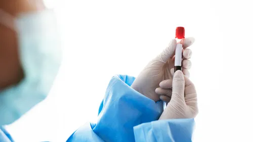 Les laboratoires Bio Ard’Aisne fermés toute la semaine