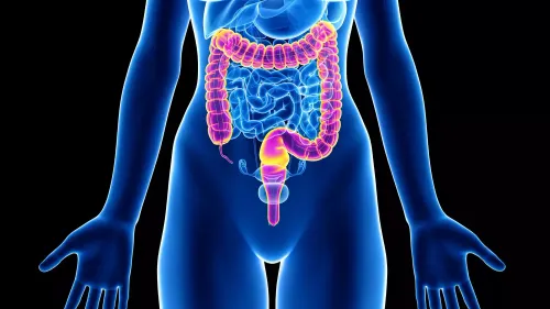 Augmentation des cancers du côlon chez les jeunes