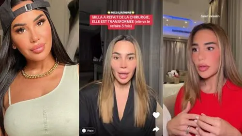 Milla Jasmine : méconnaissable après la chirurgie, son nouveau...