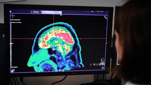 Nouvelle avancée : les ultrasons contre la dépression 