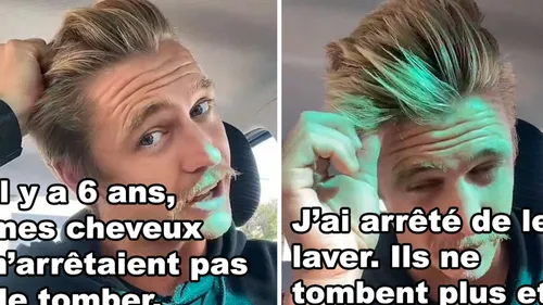 Pendant 6 ans un TikTokeur ne s'est pas laver les cheveux, ça...