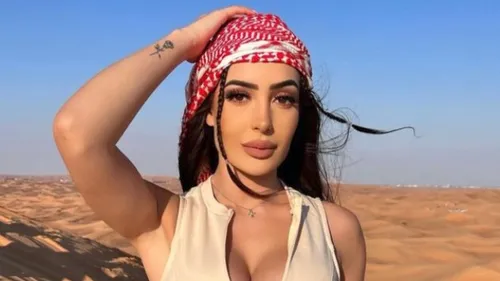 L'influenceuse Léa Mary subit une nouvelle chirurgie : son visage...