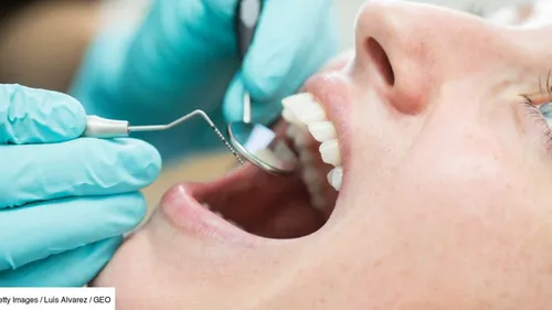 Bientôt un médicament japonais capable de faire repousser les dents