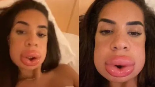 Marwa est défigurée par la chirurgie et frôle la mort !