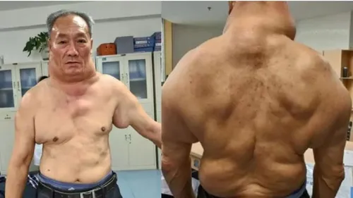 Voilà le résultat d’1 litre d’alcool par jour depuis l’âge des 13...