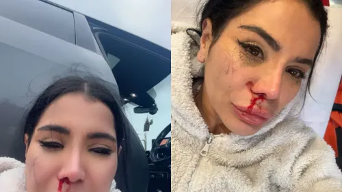 L’influenceuse Soraya Riffy porte plainte après avoir été agressée