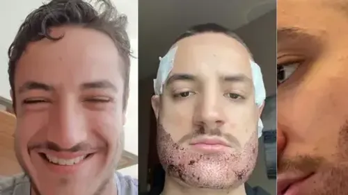 Drame de la chirurgie esthétique : un jeune homme se donne la mort...