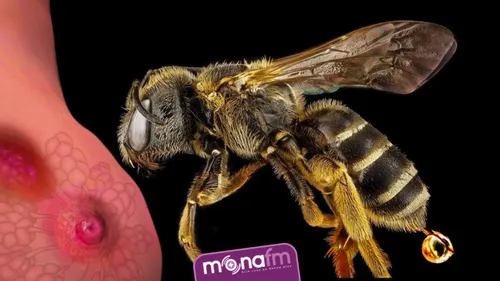 Le venin d’abeille, nouvel espoir contre le cancer du sein.