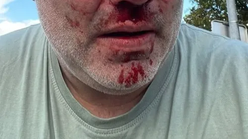 Un policier agressé à Tourcoing