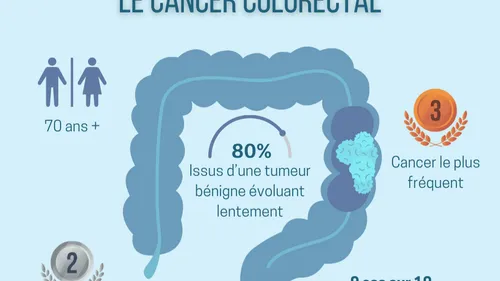 Le taux de dépistage du cancer colorectal toujours "dérisoire",...