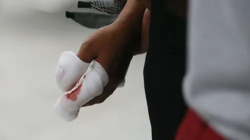 Nouvel An en Alsace : les urgences saturées après des accidents...