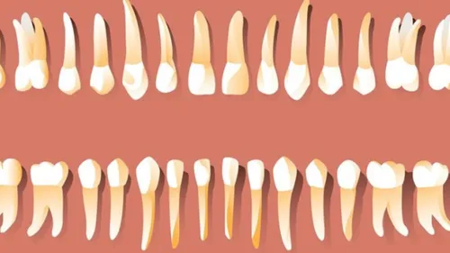 Santé : remplacer une dent arrachée par une nouvelle dent cultivée 