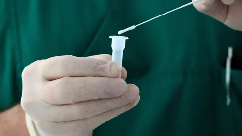 Hantavirus : la France active un dispositif sanitaire d’urgence