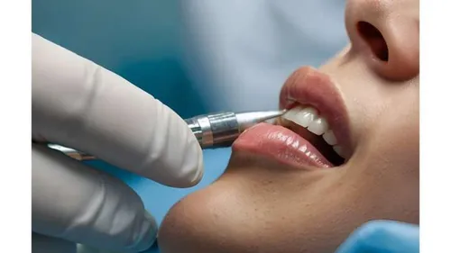 Un dentiste roumain interdit d’exercer en Eure‑et‑Loir