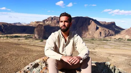 Un concert de Kendji annulé suite à sa blessure 