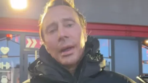 Le visage de Bob Sinclar est méconnaissable