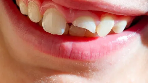 La music story du jour : Les titres de la saison Vol.3