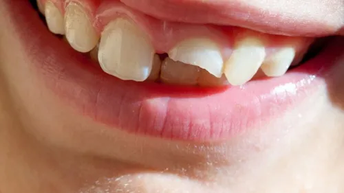 La music story du jour : Swimming Paul