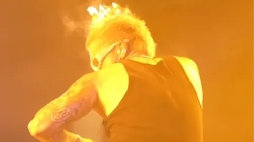 Les cheveux de Reykon prennent feu en plein concert 