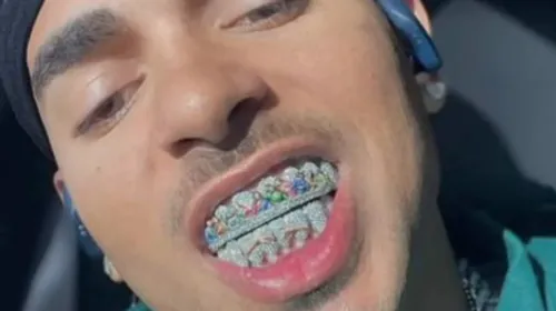 La nouvelle dentition d’Ozuna divisent les fans