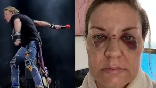 Axl Rose ne jettera plus son micro dans le public lors des concerts...