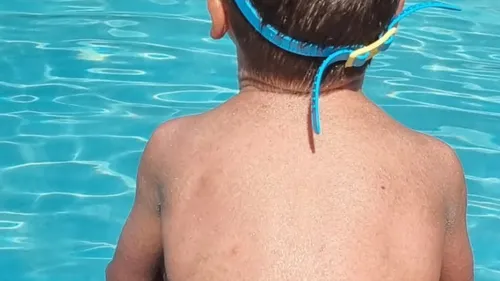 Le Chambon-Feugerolles : Privé de piscine à cause de sa maladie, le...