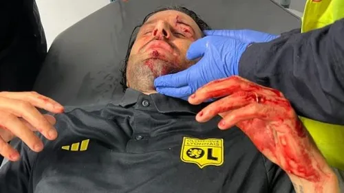 Bus de l'OL caillassé : "Des actes inadmissibles" selon la Ministre...