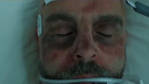 Jérémie Janot intubé et plein d'ecchymoses ... une vidéo pour...