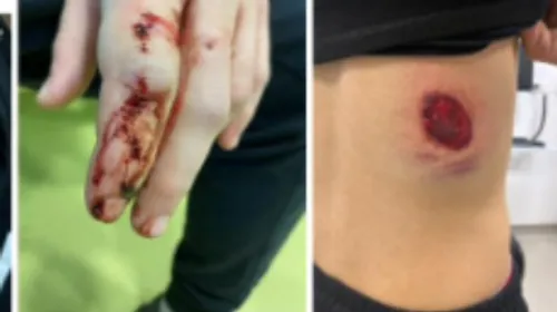 ASSE : les Green Angels dénoncent des violences policières à Dunkerque