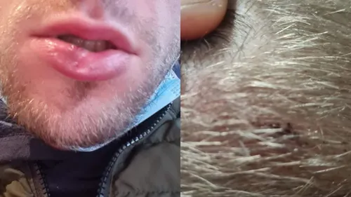 Un supporter du RC Lens accuse un stadier de l’avoir tabassé à la...