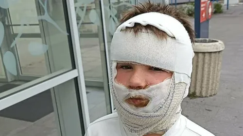 Saint-Omer : un enfant gravement brûlé après l'explosion d'un jouet...