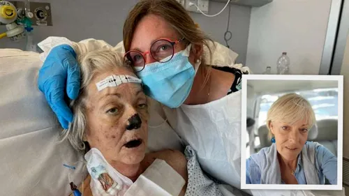 Wimereux: le SOS d'une habitante pour rapatrier sa mère malade en...